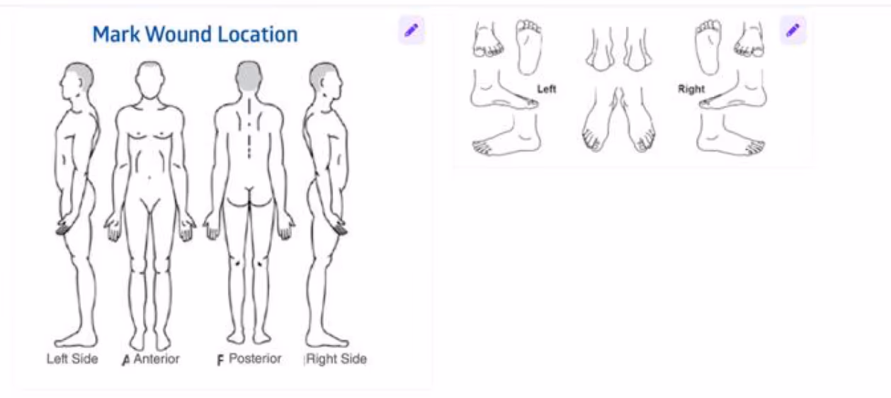 Mark Wound Location